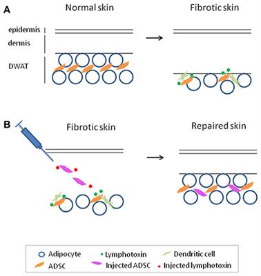 Immunopathogenesis of Juvenile Systemic Sclerosis